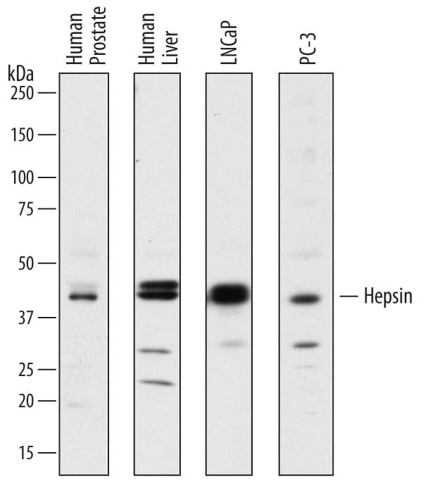 Detection of Human Hepsin antibody by Western Blot.