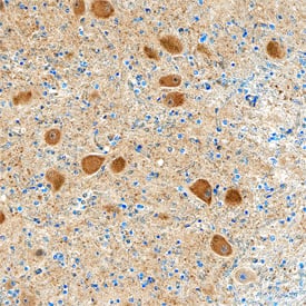 Hexokinase 1/2 antibody in Human Brain Medulla Tissue by Immunohistochemistry (IHC-P).