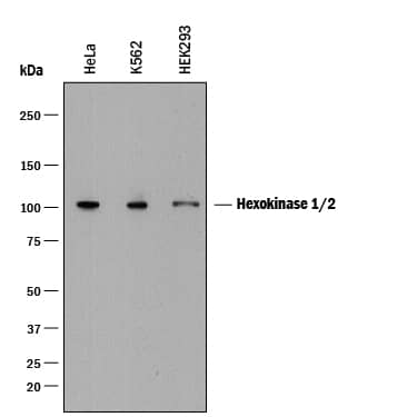 Detection of Human Hexokinase 1/2 antibody by Western Blot.