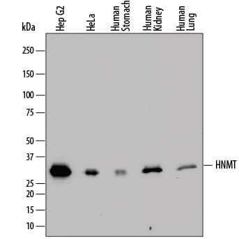 Detection of Human Histamine N-Methyltransferase/HNMT antibody by Western Blot.