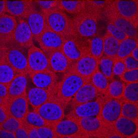 Histone Deacetylase 4/HDAC4 antibody in MCF-7 Human Cell Line by Immunocytochemistry (ICC).