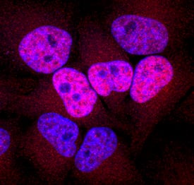 Phospho-Histone H2AX (S139) antibody in HeLa Human Cell Line by Immunocytochemistry (ICC).