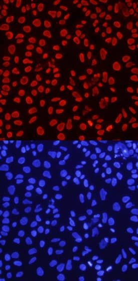 Histone H4 antibody in NTera-2 Human Cell Line by Immunocytochemistry (ICC).