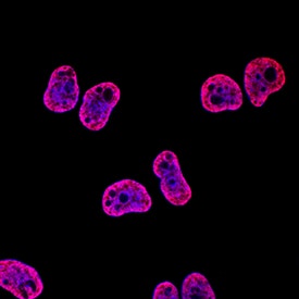 Acetyl Histone H4 (Lys5) antibody in HeLa Human Cell Line by Immunocytochemistry (ICC).