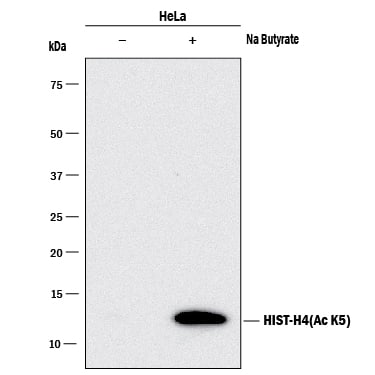 Detection of Human Acetyl Histone H4 (Lys5) antibody by Western Blot.