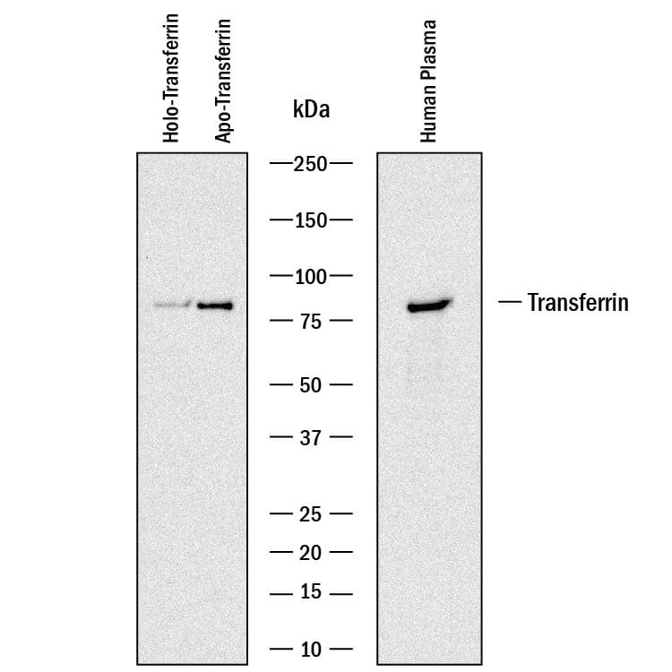 Detection of Human Transferrin and Human Apo-Transferrin antibody by Western Blot.