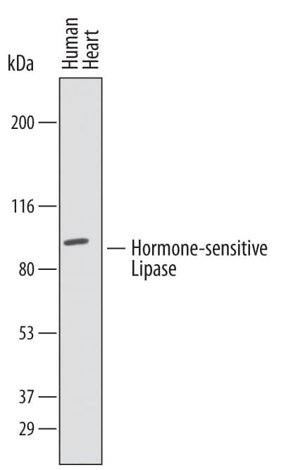 Detection of Human Hormone-sensitive Lipase/HSL antibody by Western Blot.