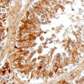 Hormone-sensitive Lipase/HSL antibody in Human Testis by Immunohistochemistry (IHC-P).