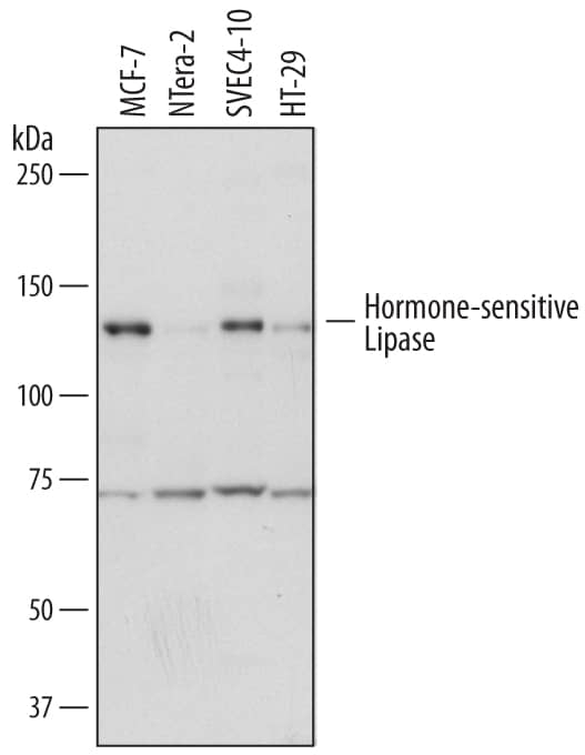 Detection of Human and Mouse Hormone-sensitive Lipase/HSL antibody by Western Blot.