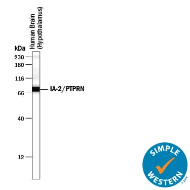 Detection of Human IA-2/PTPRN antibody by Simple WesternTM.
