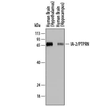 Detection of Human IA-2/PTPRN antibody by Western Blot.