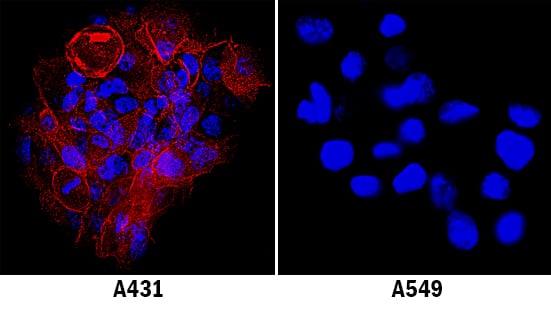 ICAM-1/CD54 antibody in A431 Human Cell Line by Immunocytochemistry (ICC).