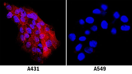 ICAM-1/CD54 antibody in A431 Human Cell Line by Immunocytochemistry (ICC).