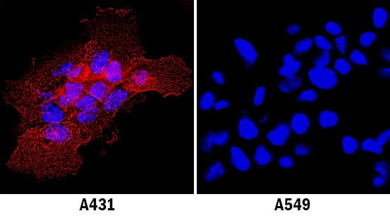 ICAM-1/CD54 antibody in A431 Human Cell Line by Immunocytochemistry (ICC).