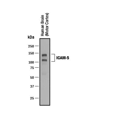 Detection of Human ICAM-5 antibody by Western Blot.