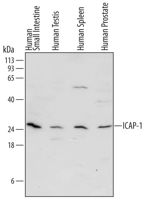 Detection of Human ICAP-1 antibody by Western Blot.