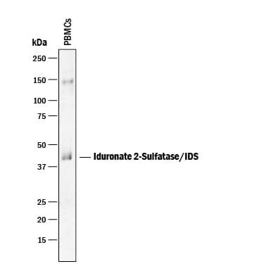 Detection of Human Iduronate 2-Sulfatase/IDS antibody by Western Blot.