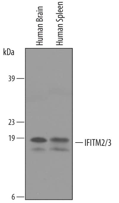 Detection of Human IFITM2/IFITM3/Fragilis antibody by Western Blot.