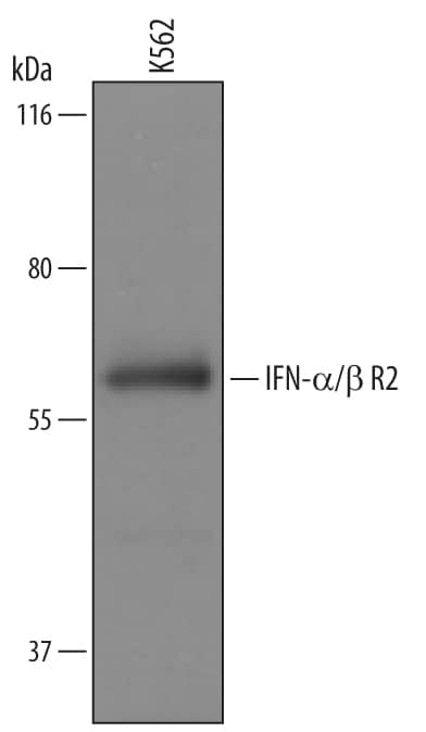 Detection of Human IFN-a/ beta R2 antibody by Western Blot.