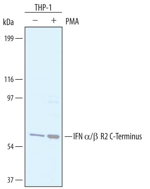 Detection of Human IFN-a/ beta R2 antibody by Western Blot.