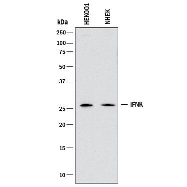 Detection of Human IFN-alpha 6/IFNA6 antibody by Western Blot.