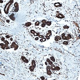 IFN-beta  antibody in Human Breast by Immunohistochemistry (IHC-P).