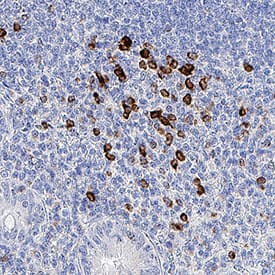 IFN-gamma antibody in Human Appendix by Immunohistochemistry (IHC-P).