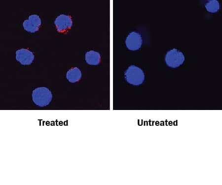 IFN-? antibody in Mouse Splenocytes by Immunocytochemistry (ICC).