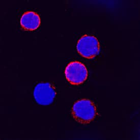 IFN-? R1/CD119 antibody in Human PBMCs by Immunocytochemistry (ICC).