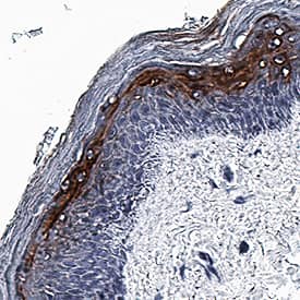 IFN-kappa antibody in Human Skin by Immunohistochemistry (IHC-P).