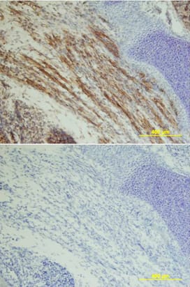 IGF-I R/IGF1R antibody in Mouse Embryo by Immunohistochemistry (IHC-Fr).