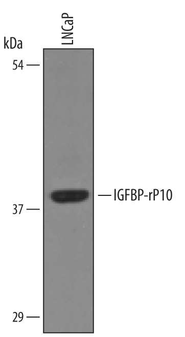 Detection of Human IGFBP-rP10 antibody by Western Blot.