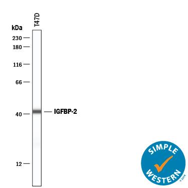 Detection of Human IGFBP-2 antibody by Simple WesternTM.