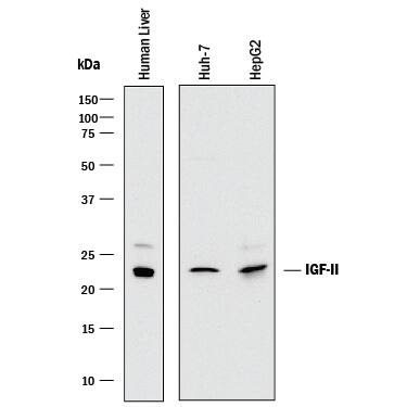 Detection of Human IGF-II/IGF2 antibody by Western Blot.