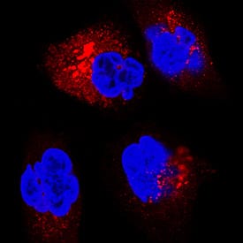 IGF-II R/IGF2R antibody in A172 Human Cell Line by Immunocytochemistry (ICC).