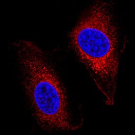 IGF-II R/IGF2R antibody in A549 Human Cell Line by Immunocytochemistry (ICC).