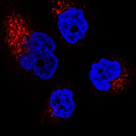 IGF-II R/IGF2R antibody in A172 Human Cell Line by Immunocytochemistry (ICC).