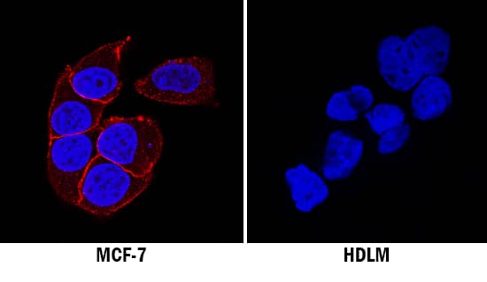 IGF-I R/IGF1R antibody in MCF-7 and HDLM Human Cell Lines by Immunocytochemistry (ICC).