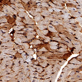 IGF-I R/IGF1R antibody in Mouse Heart by Immunohistochemistry (IHC-P).