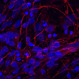 IGSF4B/SynCAM3 antibody in BG01V Human Embryonic Stem Cells by Immunocytochemistry (ICC).