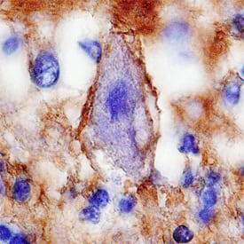 IGSF4B/SynCAM3 antibody in Human Brain by Immunohistochemistry (IHC-P).