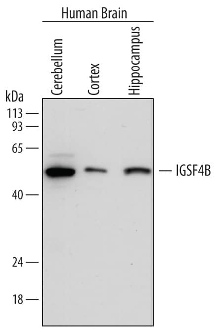 Detection of Human IGSF4B/SynCAM3 antibody by Western Blot.