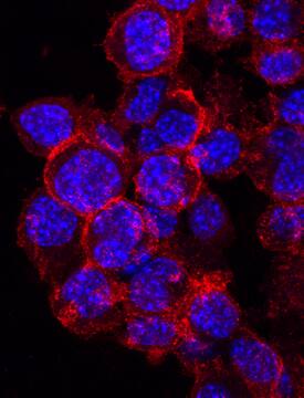 IGSF8/CD316 antibody in Neuro-2A Mouse Cell Line by Immunocytochemistry (ICC).