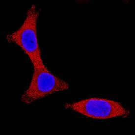 IKKa antibody in HCT-116 Human Cell Line by Immunocytochemistry (ICC).
