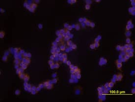 IKKe antibody in Human PBMCs by Immunocytochemistry (ICC).