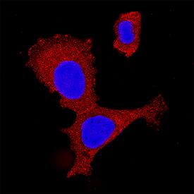 IKK? antibody in MCF-7 Human Cell Line by Immunocytochemistry (ICC).