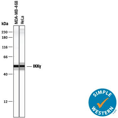 Detection of Human IKK? antibody by Simple WesternTM.