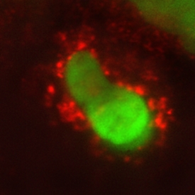 IL-10 Ra antibody in Human PBMCs by Immunocytochemistry (ICC).