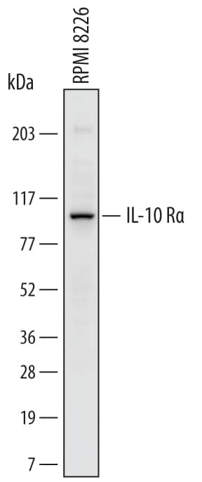 Detection of Human IL-10 Ra antibody by Western Blot.