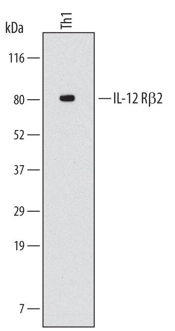 Detection of Human IL‑12 R beta2 by Western Blot. Detection of Human IL-12 R beta2 antibody by Western Blot.